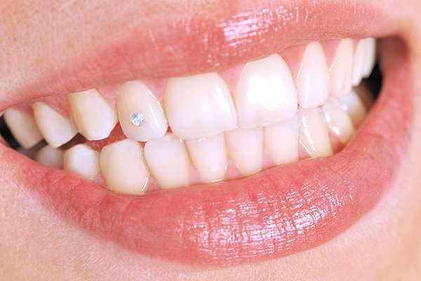 Q: Is Tooth Jewelry Safe?  Dental Image Therapy Centres